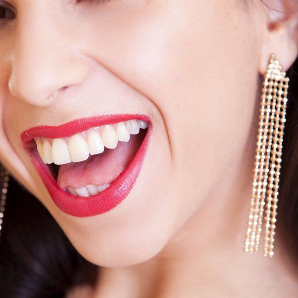 Pendiente Opción Largo